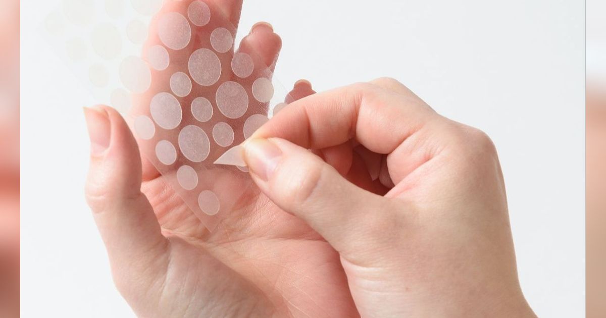 Bukan Dipakai Terus Menerus, Ini Cara Pakai Acne Patch yang Aman dan Dianjurkan Dokter