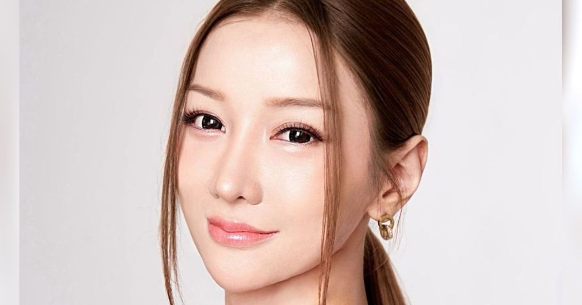 Fakta-fakta Prosedur Kecantikan Stem Cell yang Bikin Lucinta Luna bak Gadis Korea