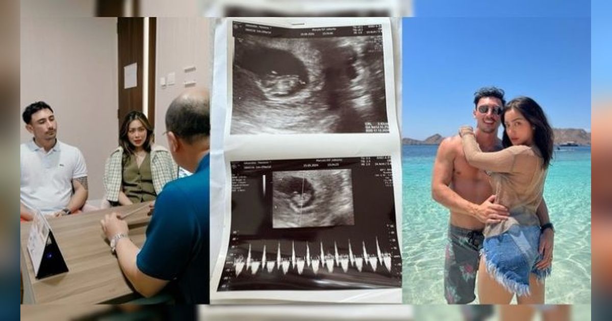 Sedang Mengandung, Jessica Iskandar Urungkan niat Miliki Bayi Kembar, Alasannya Mengejutkan