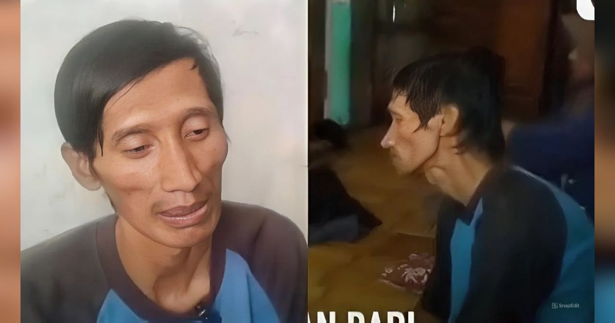 Viral Kisah Solihin Warga Garut Tidak Tidur 4 Tahun, Diduga Alami Kelainan
