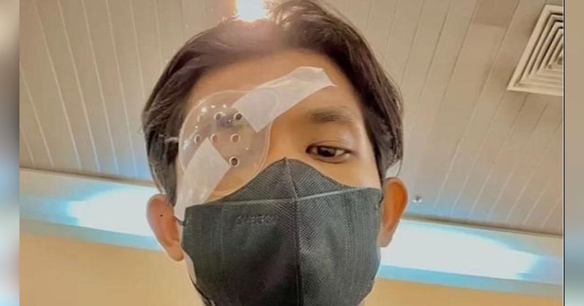 Sering Kucek Mata Berlebihan, Pria Malaysia Ini Berakhir Harus Transplantasi Kornea