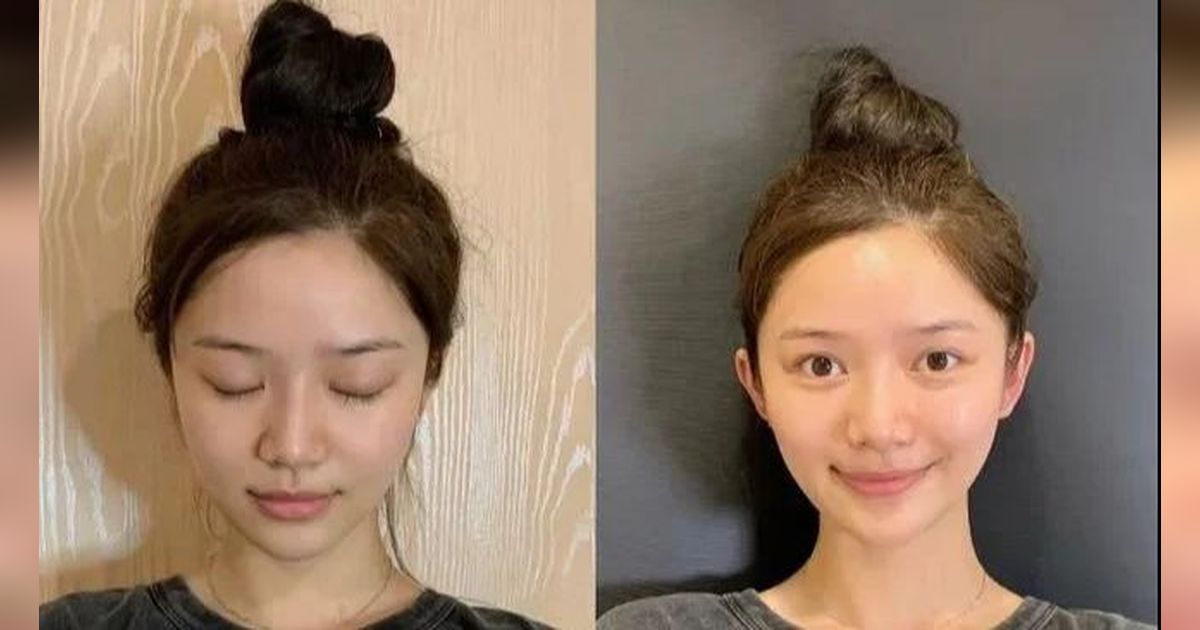 Di China, Sedang Trend Telinga Peri yang Menonjol dan Dianggap Salah Satu Simbol Kecantikan
