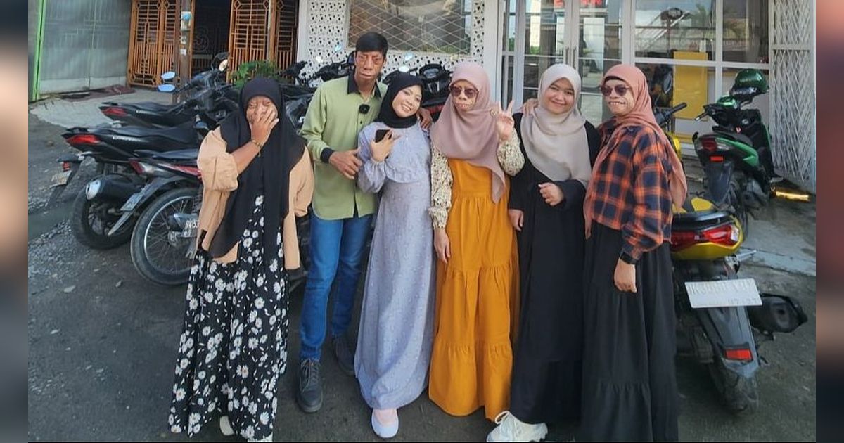 8 Potret Dapur Rumah Keluarga Manurung 'Pengidap Sindrom Langka'