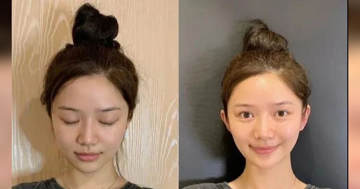 Telinga Peri yang Menonjol Jadi Simbol Kecantikan Sekaligus Tren di China
