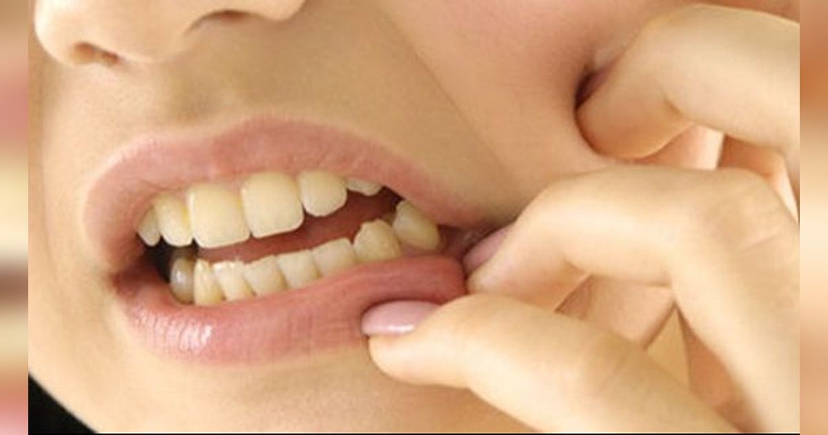 Viral Seorang Perempuan Asal Ngawi Meninggal Usai Cabut Gigi Bungsu