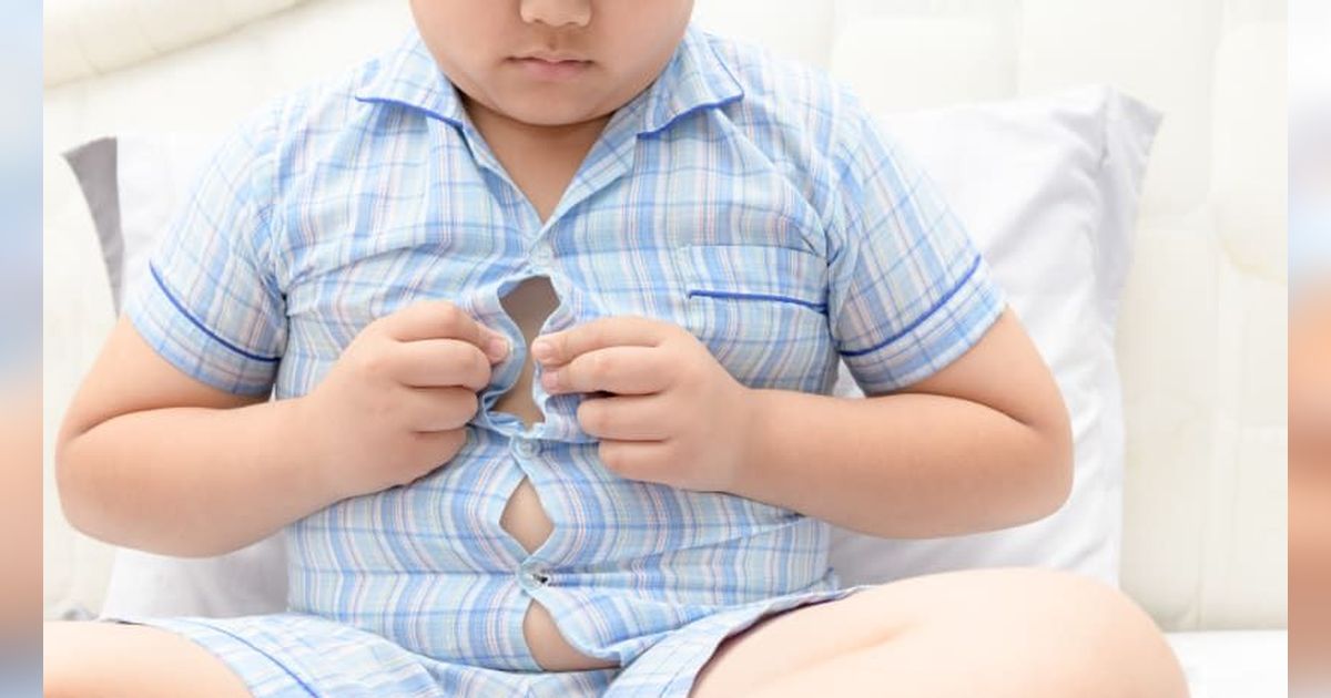 Bahaya Obesitas pada Anak yang Perlu Diwaspadai, Begini Cara Mengatasinya