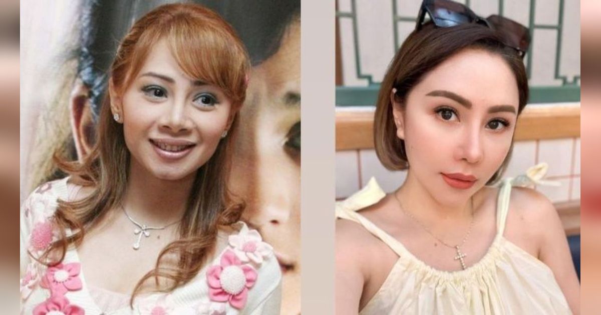 9 Transformasi Artis Sebelum dan Sesudah Filler Dagu, Wajah Makin Tirus Bikin Pangling