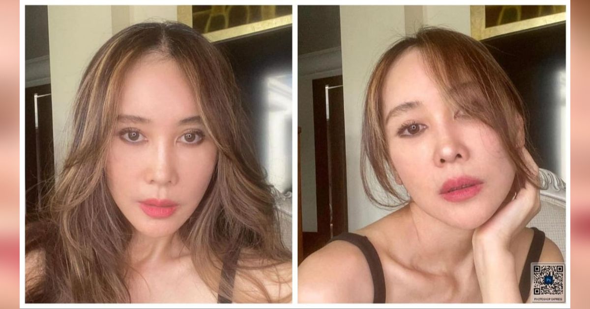 Potret Terbaru Ina Istri Jeremy Thomas Lakukan Oplas Facelift di Korea Selatan,  Hasilnya Bikin Melongo!
