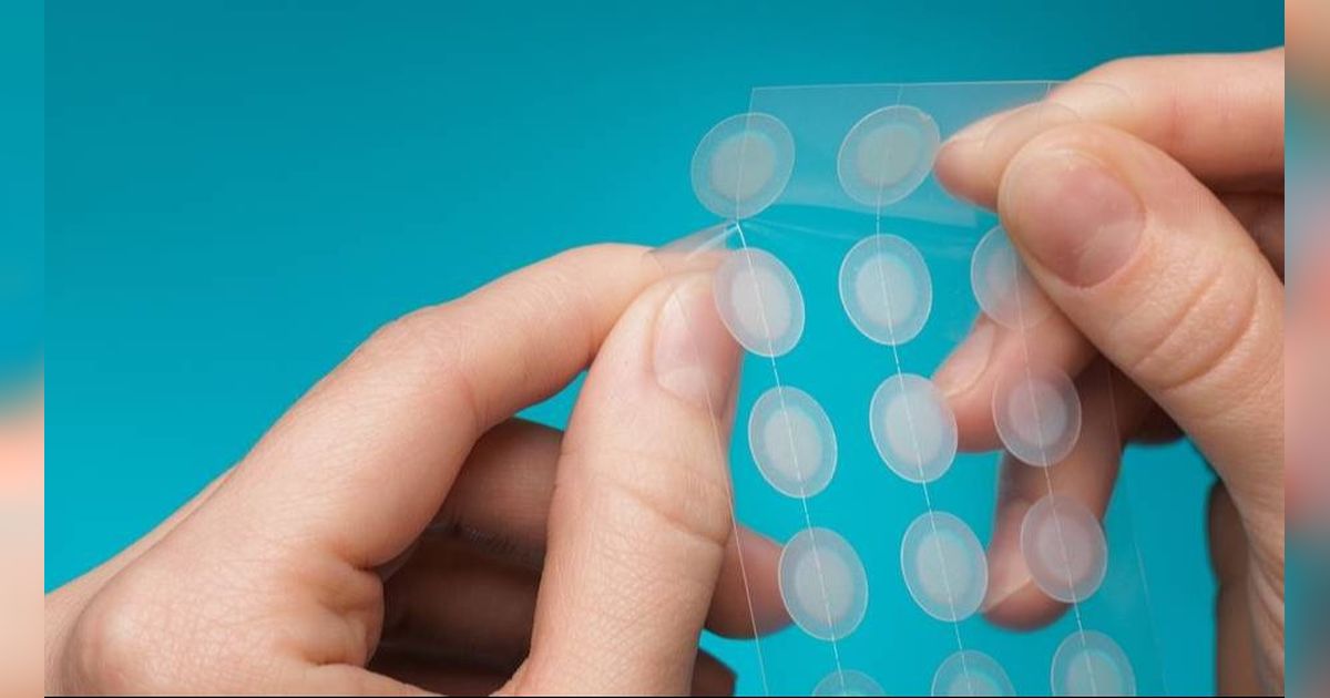 Panduan Memilih Acne Patch Tepat Sesuai Jenis Jerawat, Biar Tak Salah Beli