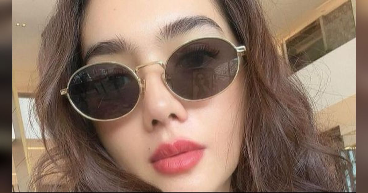 Potret Wajah Terbaru Angel Karamoy Usai Oplas 3 Bulan, Netizen: 