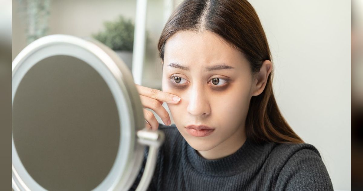 Bukan Cuma Kurang Tidur, Konsumsi Kafein Berlebih Bikin Kantong Mata Makin Parah
