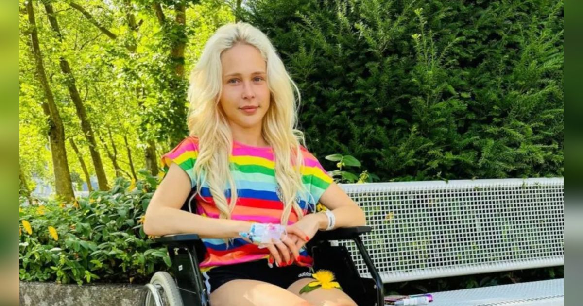 Cerita Model Jerman Habiskan Rp2,6 Miliar untuk Operasi Kaki Biar Lebih Jenjang