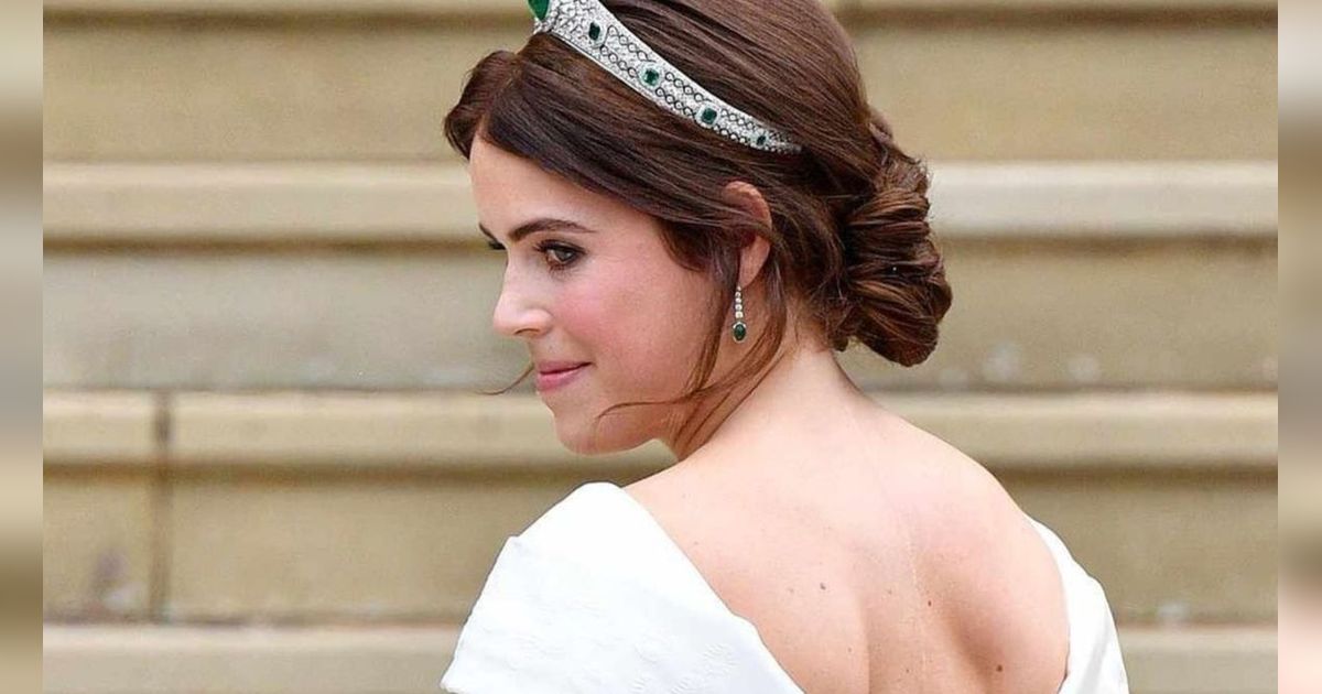 Cerita Luka Besar di Punggung Putri  Eugenie dari Inggris karena Skoliosis Bikin Ngilu