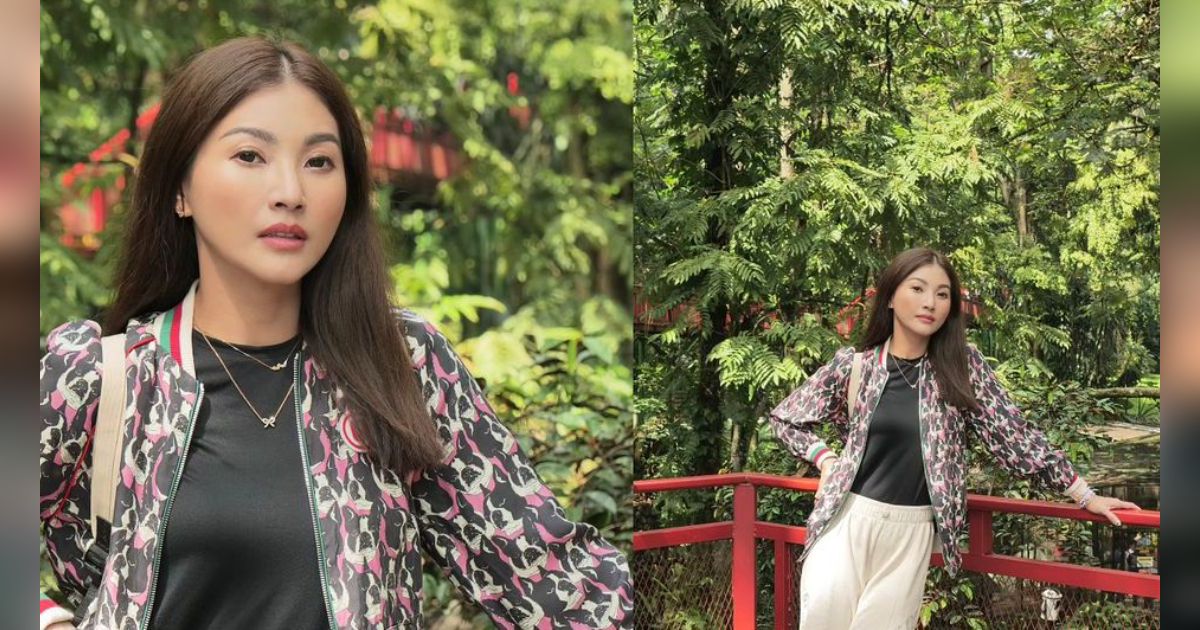 Wajah Baru Sarwendah Setelah Oplas di Korea Selatan Dinyinyirin Netizen