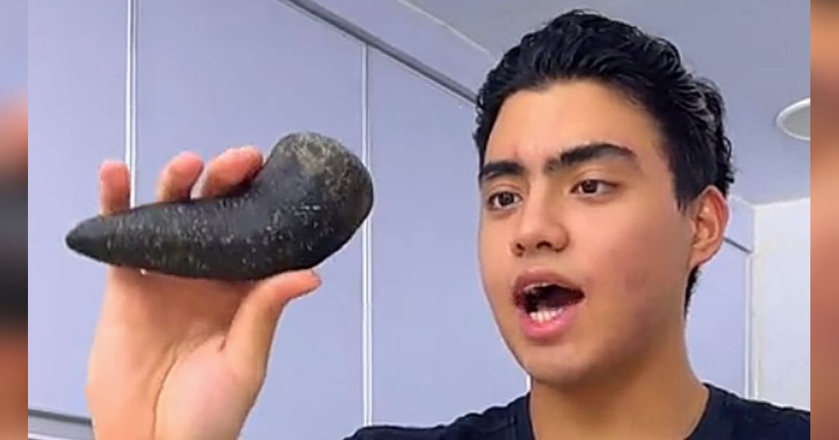 Heboh Konten di TikTok Ulekan Sebabkan Batu Ginjal Ternyata Hoax, Simak Faktanya