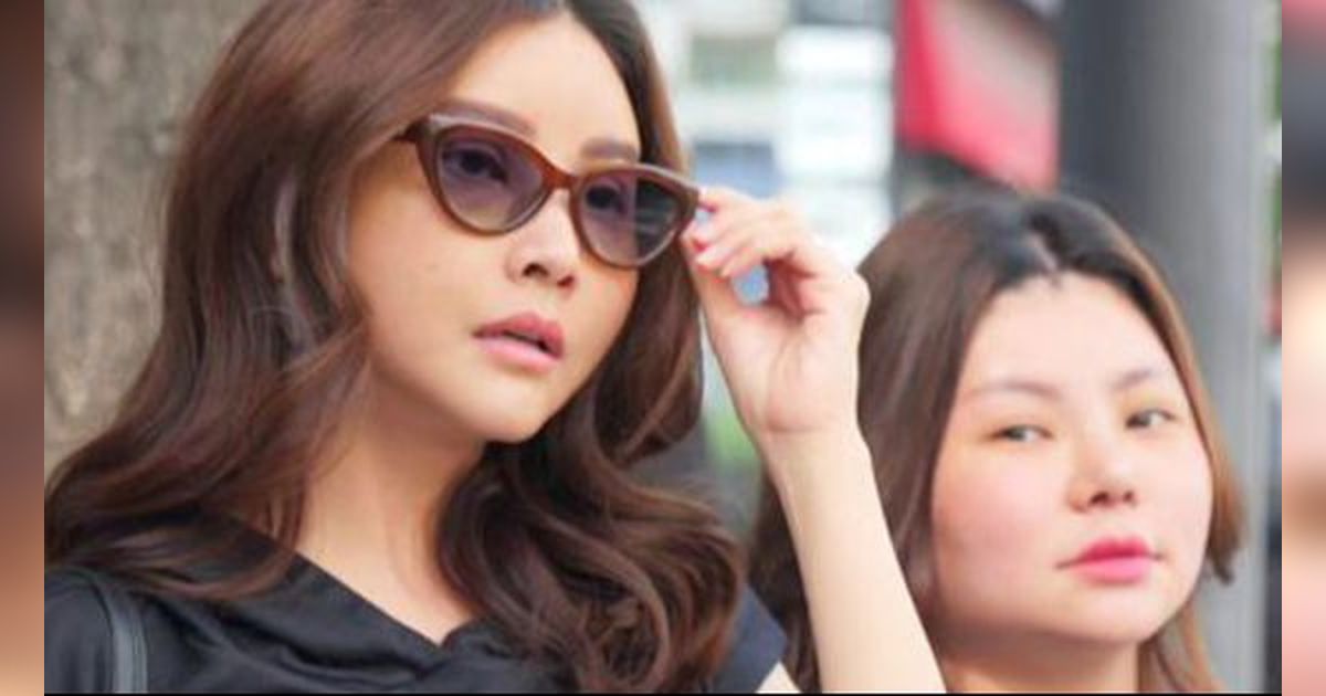 Potret Wajah Baru Sarwendah Usai Menjalani Oplas, Sudah Bisa Dandan Lagi
