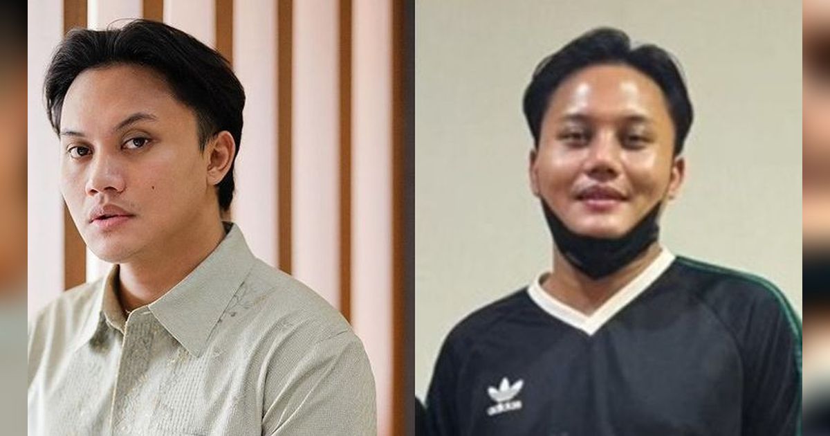 Rizky Febian Diduga Oplas Ikuti Jejak Mahalini, Hidungnya Jadi Sorotan