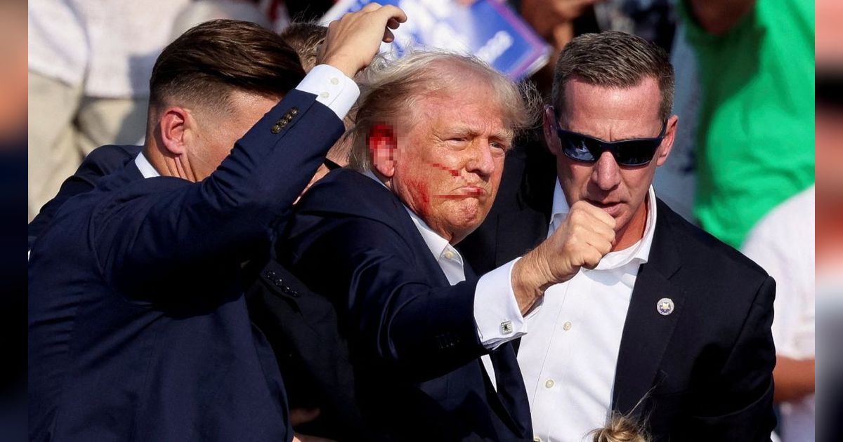 FOTO: Inilah Luka Donald Trump yang Tertembak saat Kampanye Pilpres Amerika Serikat