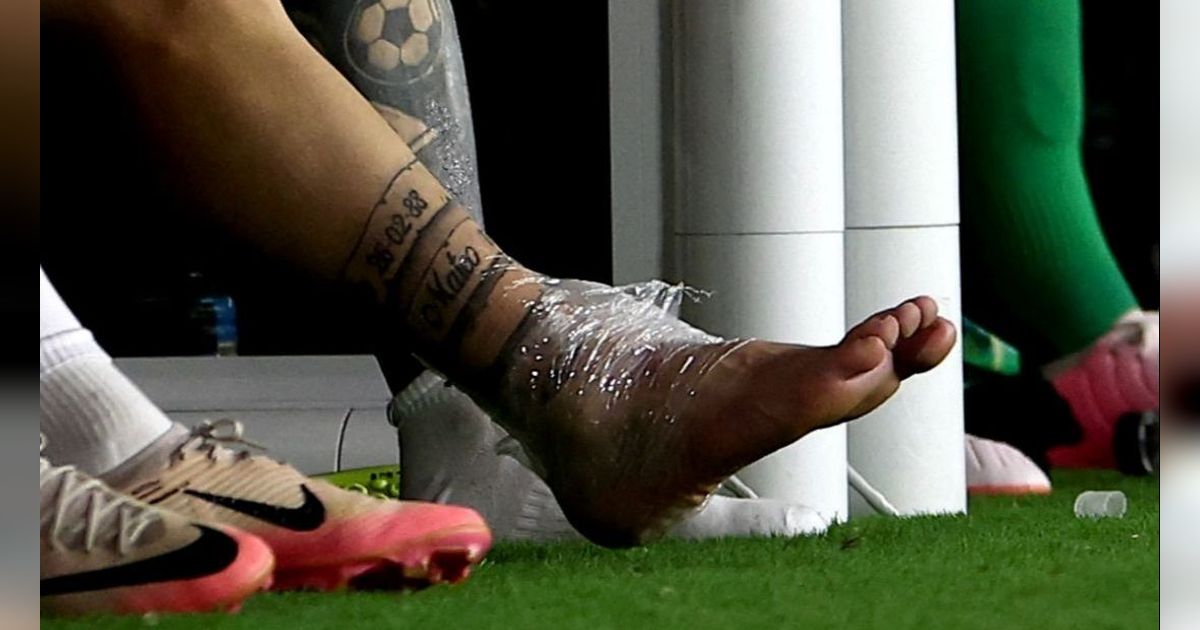 FOTO: Penampakan Bengkak Kaki Messi yang Keseleo hingga Membuat Menangis Tersedu-sedu di Final Copa America 2024