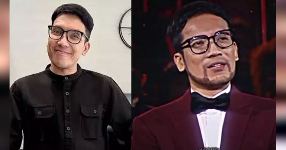 10 Artis Sebelum VS Sesudah Transplantasi Rambut, Desta Berubah Banget, Dikira Beda Orang!