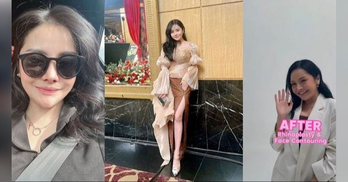 Potret Terbaru Mawar AFI yang Makin Cantik Usai Oplas di Korea Selatan, Hasilnya Dinilai Berhasil