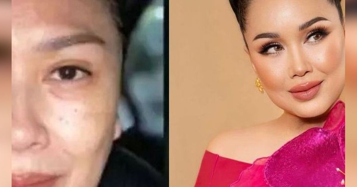 Kembali Muda Bak ABG, 9 Potret Transformasi Artis Indonesia Sebelum & Sesudah Face Lifting