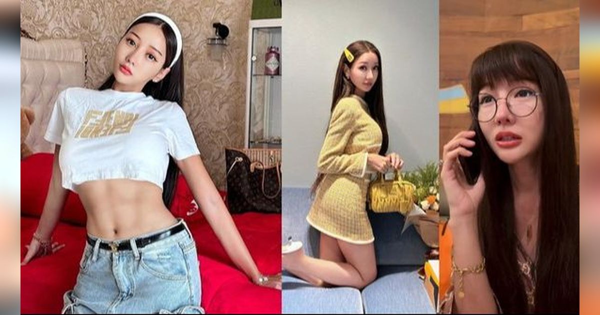 Jadi Kayak Barbie, Berikut 8 Potret Terbaru Lucinta Luna yang Sudah Pulih dari Operasi Terakhir