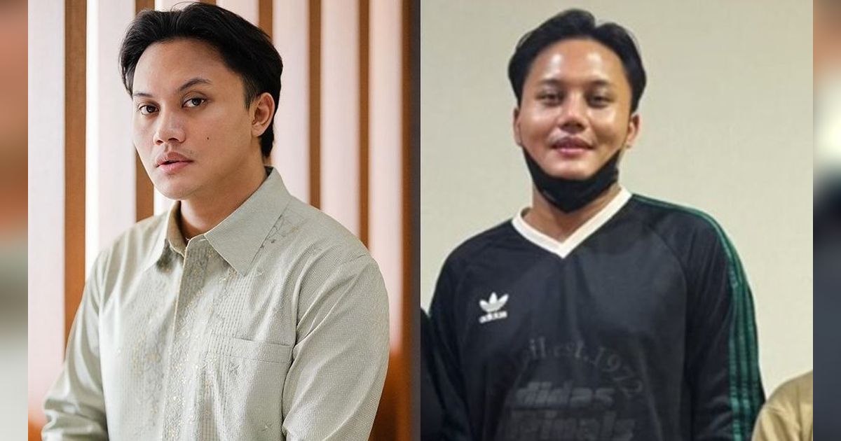10 Artis Sebelum VS Sesudah Oplas di Tahun 2024, Mahalini Raharja & Rizky Febian Malah Dinyinyiri