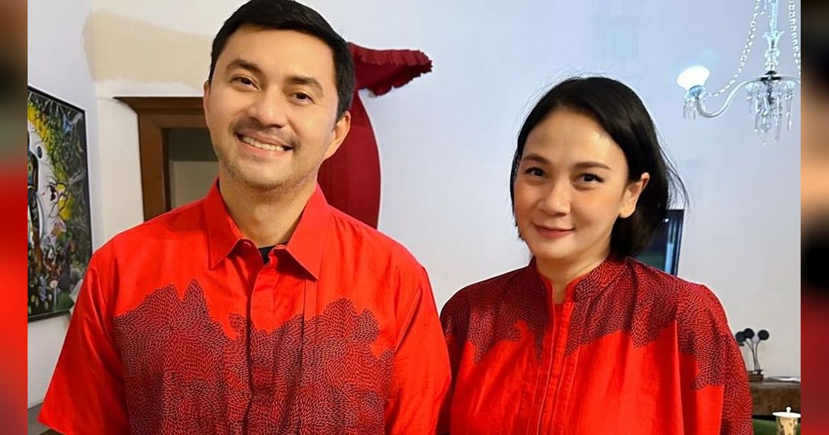 8 Potret Dian Nitami Istri Anjasmara Setelah Oplas di Korea, Hasilnya Bagus Banget, Balik Jadi ABG!