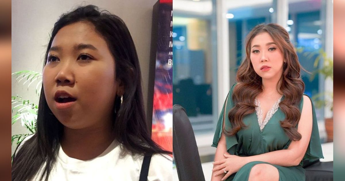 Potret Transformasi Artis yang Lakukan Treatment  Filler Dagu