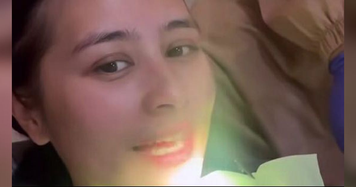 10 Potret Penampilan Terbaru Prilly Latuconsina, Kini Pakai Behel