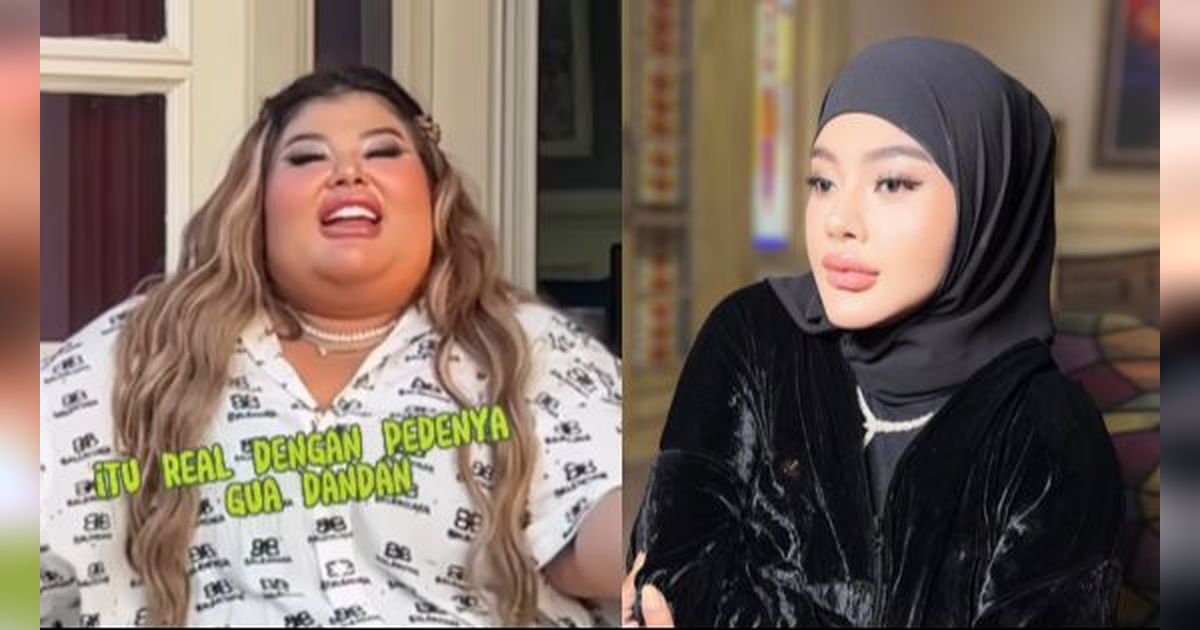 Transformasi Mencengangkan Shindy Samuel Usai Jalani Operasi Bariatrik, Bobotnya Pernah Mencapai 155 Kg