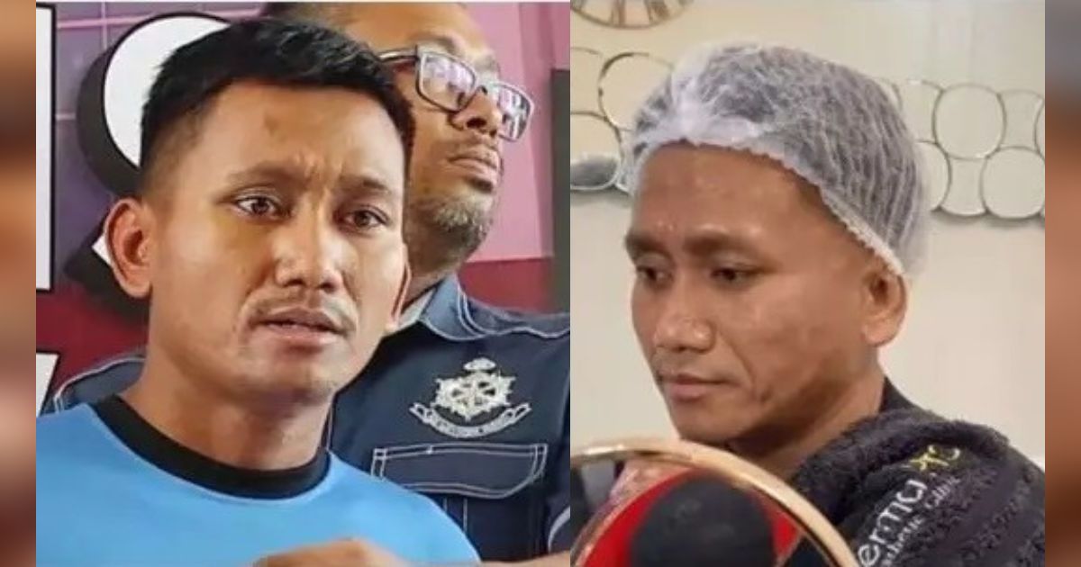 9 Potret Pegi Setiawan Makin 'Glowing' Setelah Jadi Seleb TikTok, Rutin Perawatan di Klinik Kecantikan
