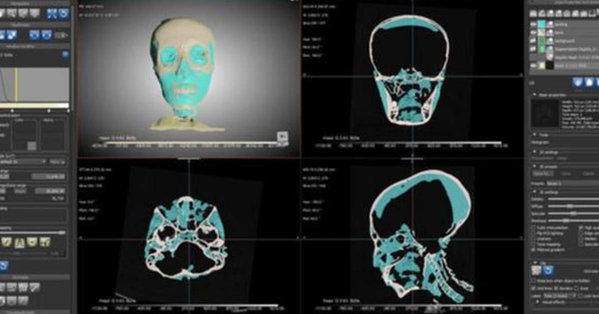 3 300 Tahun Jadi Misteri Wajah Asli Firaun Tutankhamun Akhirnya Terungkap