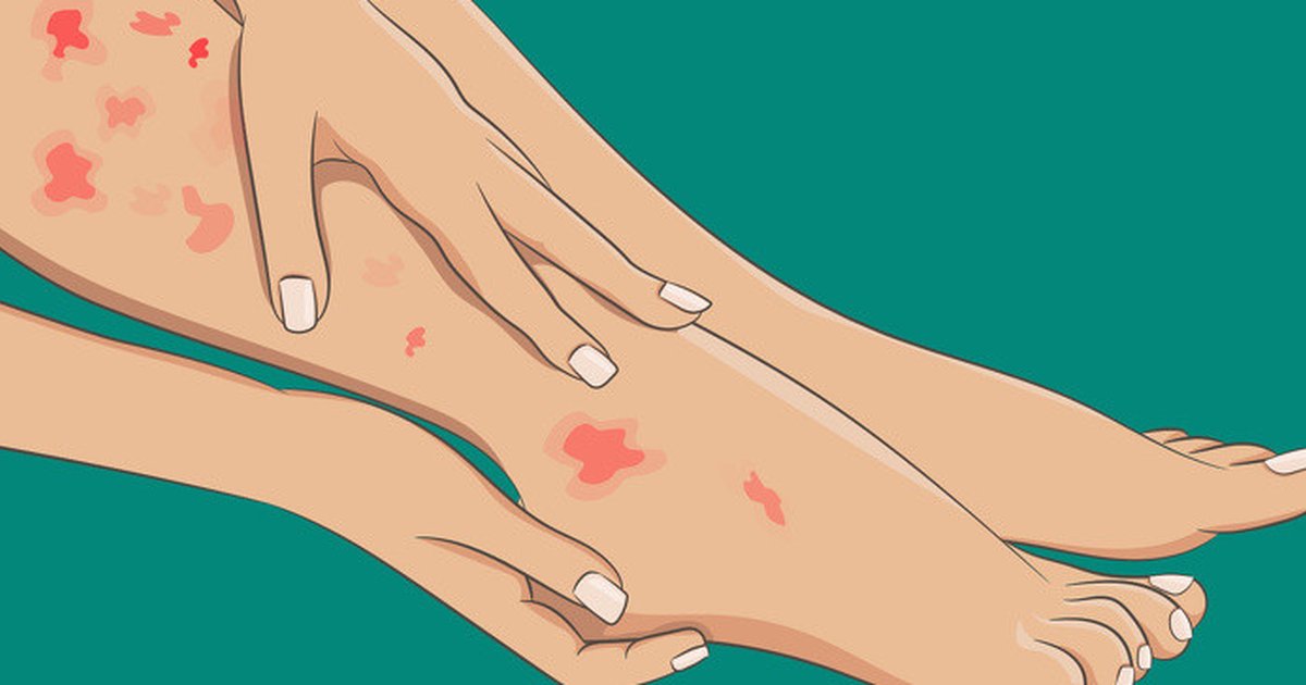 Telapak Kaki Mati Rasa Bisa Jadi Tanda Masalah Kesehatan Serius,Ini Cara Mengatasinya