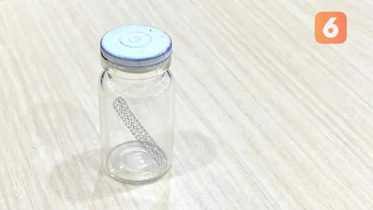 Stent atau ring untuk tindakan Primary PCI, Prosedur Intervensi Non-Bedah yang Ubah Dunia Kedokteran Jantung, Jakarta (20/10/2023). Foto: Ade Nasihudin/Liputan6.com.