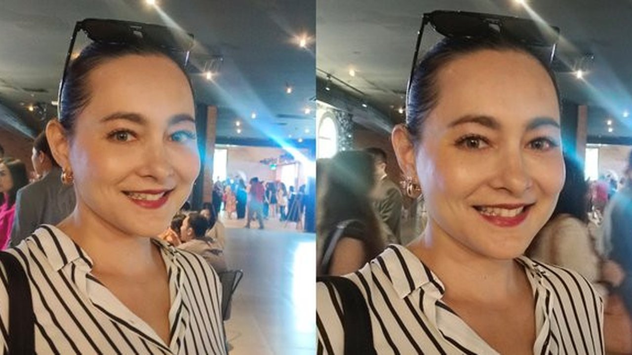 Dewi Rezer Ungkap Masalah Kantong Mata dan Keputusan untuk Menjalani Operasi Plastik