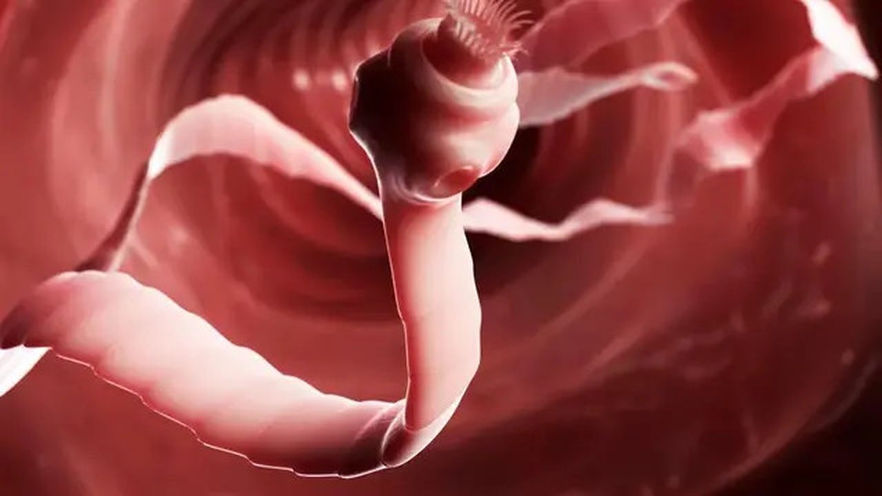 Wanita Ini Minum Pil Berisi Telur Cacing Pita Babi Demi Diet (Sumber: Sciepro/Corbis)