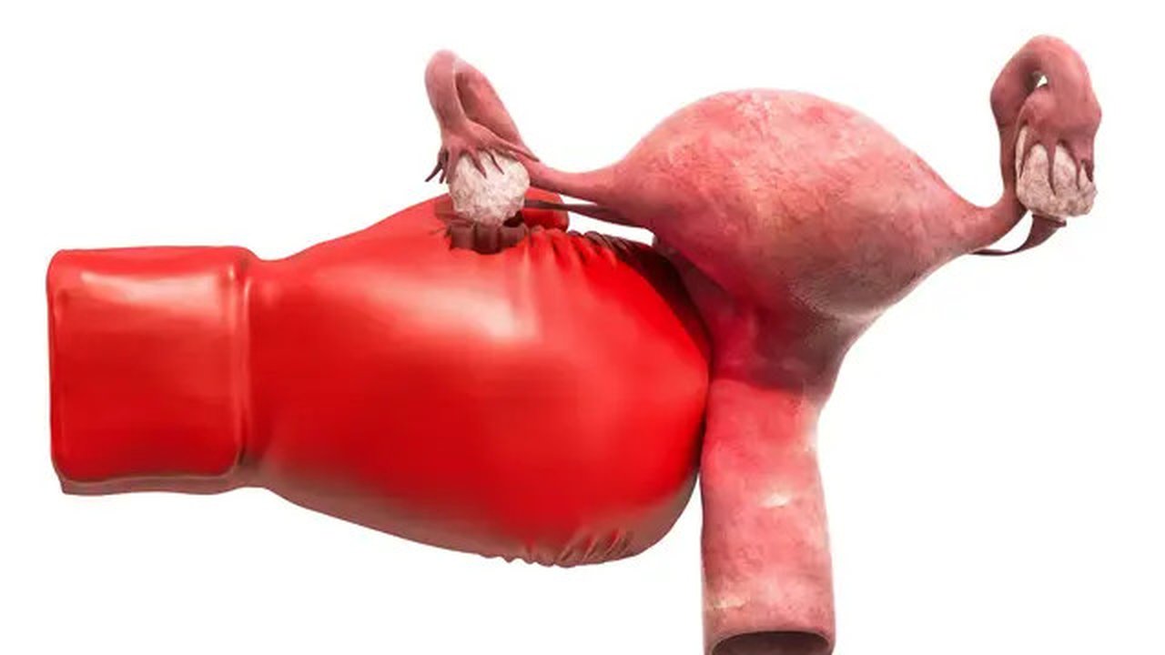 Penyakit Miom (sumber: istockphoto)