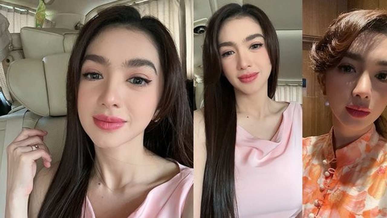Potret Angel Karamoy yang Dipuji Makin Cantik Usai Oplas di Korea, Hidung Tampak Berbeda