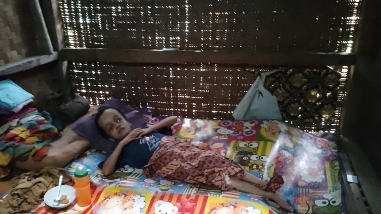 Ani, gadis penderita hidrosefalus (penumpukan cairan di rongga otak) berusia 18 tahun dari Kabupaten Lebak butuh donatur untuk menyembuhkan penyakit yang ...