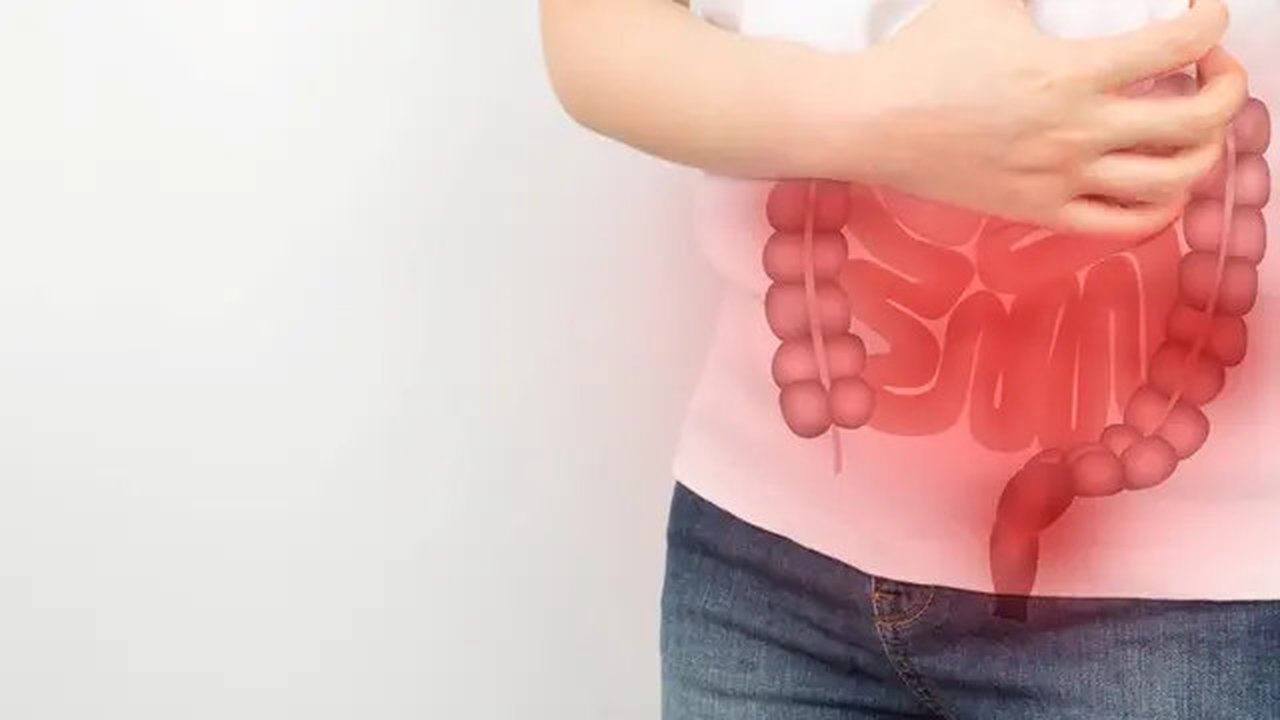 Ilustrasi penyakit pada usus besar. (Orawan Pattarawimonchai)
