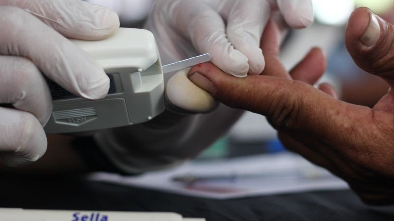 Kemenkes menekankan pentingnya kepesertaan BPJS Kesehatan aktif untuk mengakses pemeriksaan kesehatan gratis di hari ulang tahun, dengan tenggat waktu 30 hari untuk aktivasi.