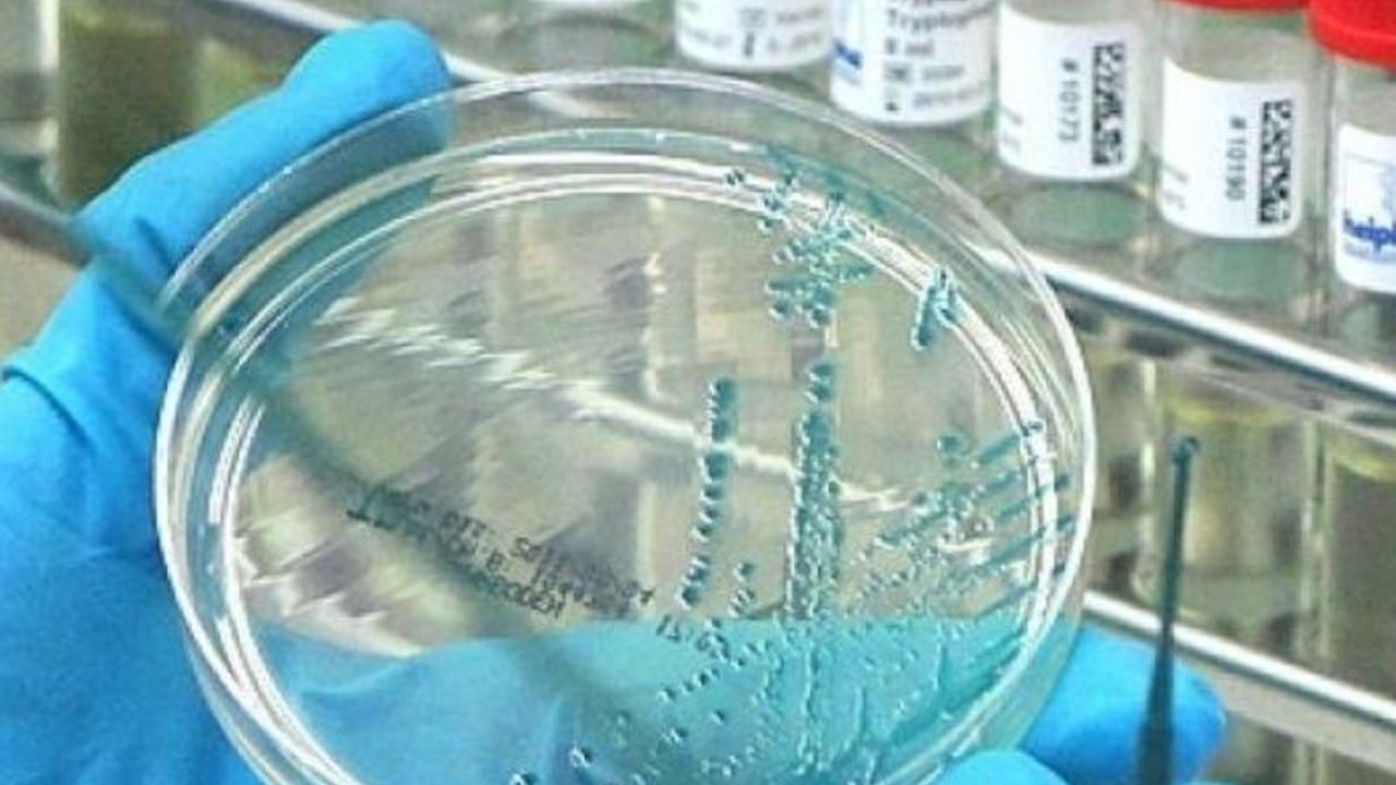 Badan Kesehatan Inggris mengkonfirmasi kasus infeksi flu burung A(H5N1) pada manusia di wilayah West Midlands, Inggris, dengan risiko penyebaran ke masyarakat luas dinilai sangat rendah.