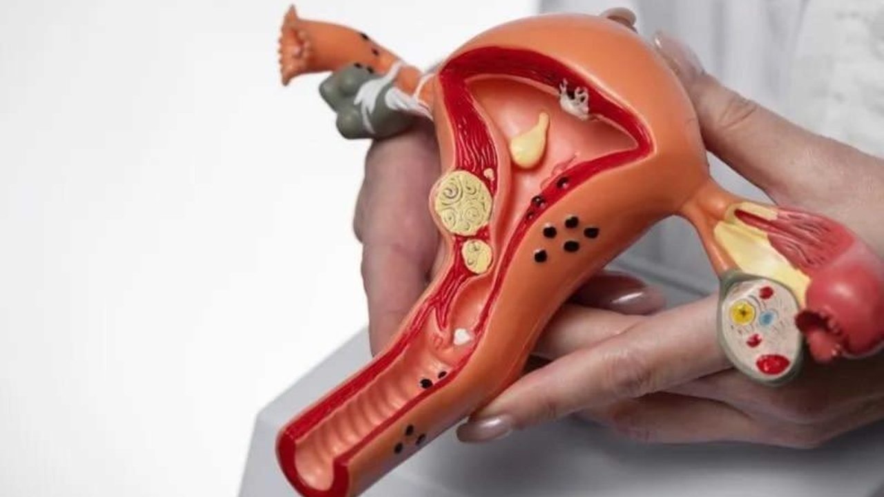 Pemerintah Indonesia meluncurkan rencana aksi nasional untuk mengatasi empat kanker prioritas, dengan target utama eradikasi kanker serviks dan penurunan angka kematian akibat kanker payudara, paru-paru, dan usus besar.