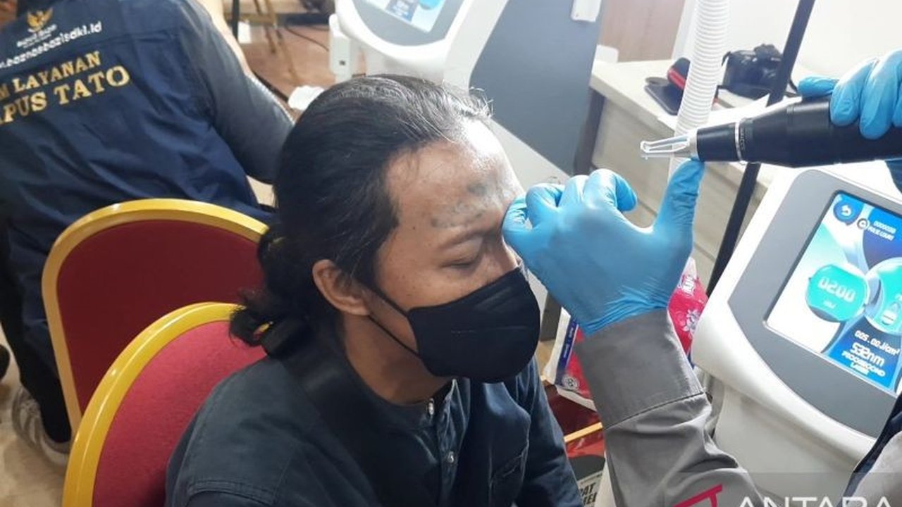 Warga Jakarta memanfaatkan program hapus tato gratis Baznas DKI Jakarta selama Ramadhan untuk menghapus jejak masa lalu dan memperbaiki diri, menjalani proses yang cukup menyakitkan namun bermakna.