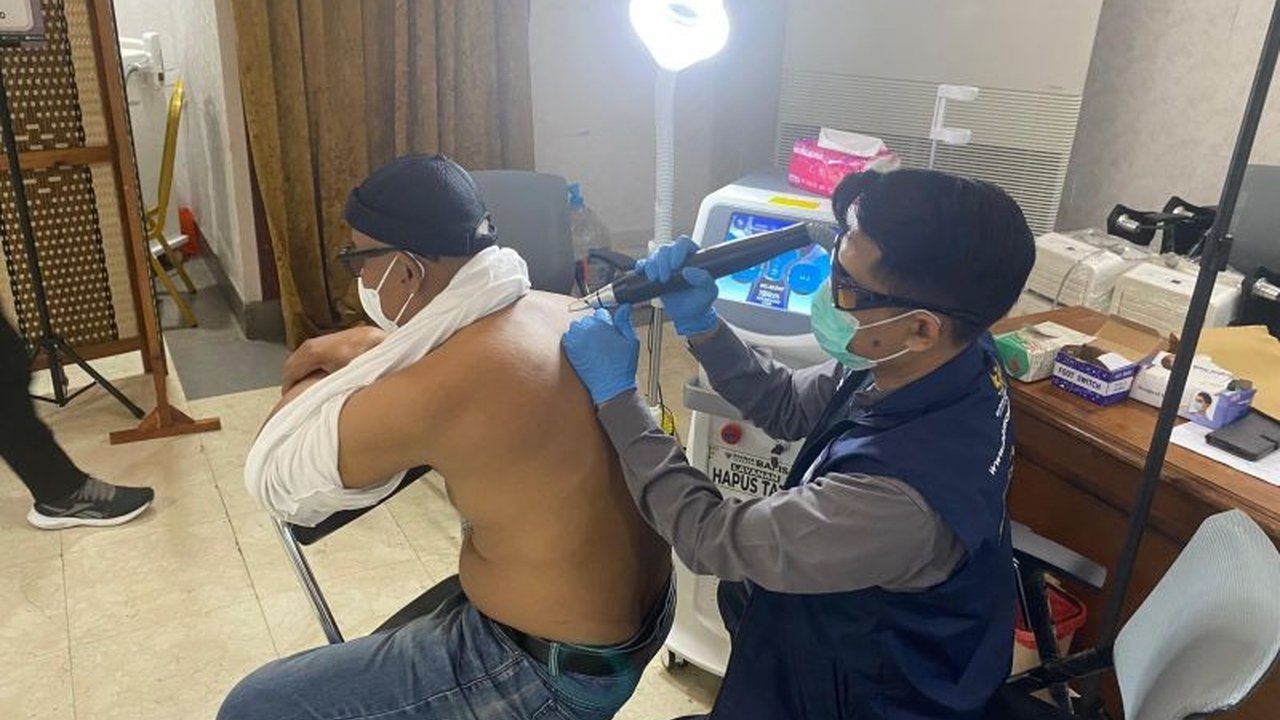 Antusiasme Warga Jaksel Hapus Tato Gratis di Program Baznas-Bazis DKI