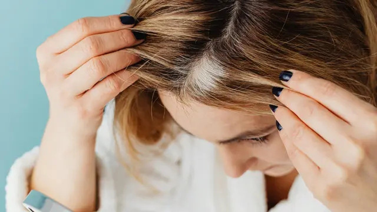 Permasalahan kulit kepala menjadi permasalahan umum di iklim tropis. (Foto: Pexels/Karolina Grabowska)