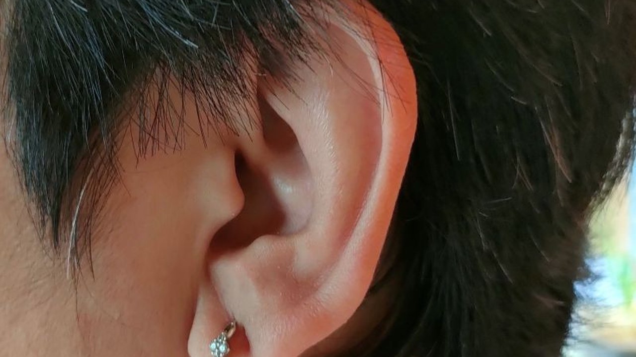 Kementerian Kesehatan (Kemenkes) RI gencar promosikan Cek Kesehatan Gratis (CKG) untuk mencegah ketulian sejak dini, menanggapi data WHO tentang tingginya angka gangguan pendengaran global.