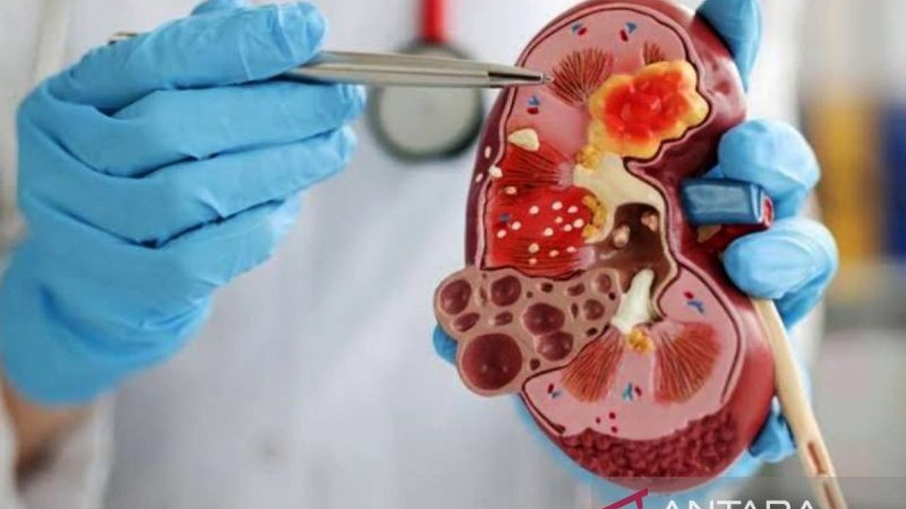 Dokter Anindia Larasati dari RS UI mengingatkan bahwa hipertensi, diabetes, dan obesitas meningkatkan risiko gagal ginjal, sehingga penting untuk melakukan evaluasi fungsi ginjal secara rutin.